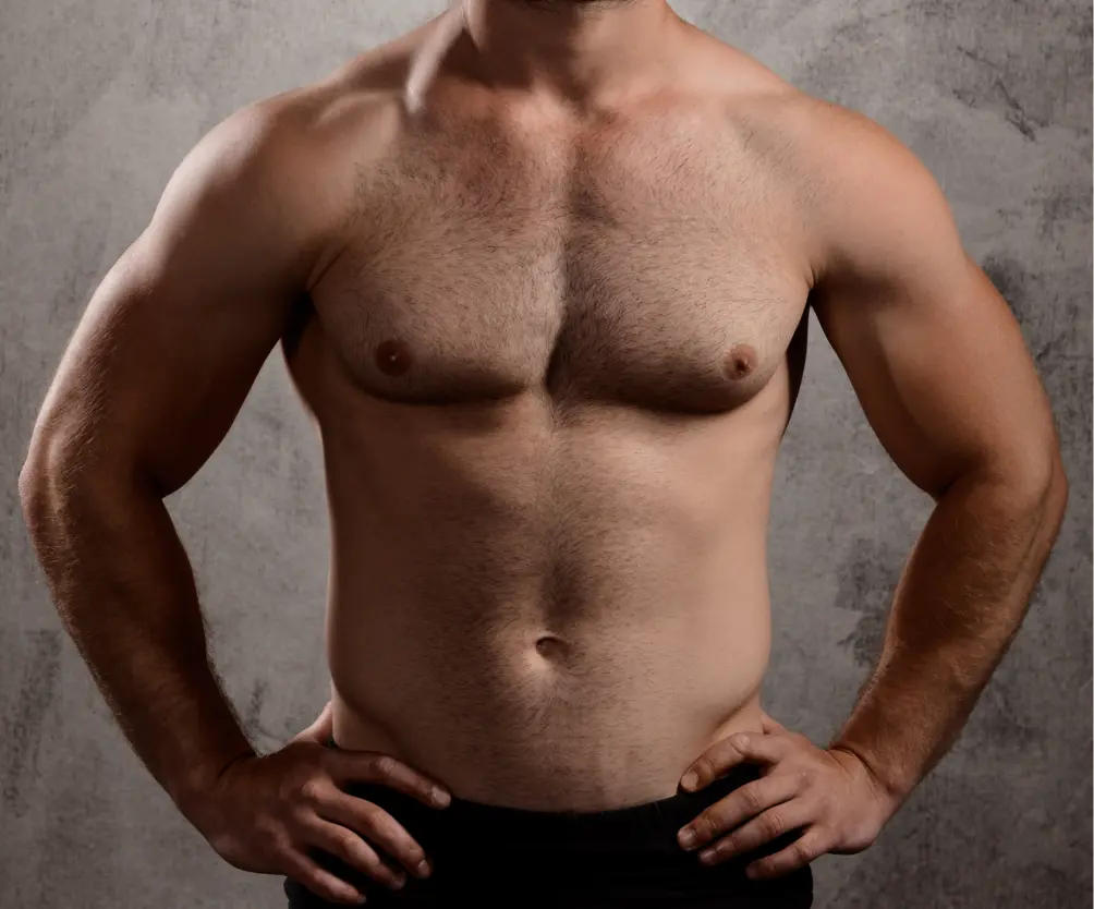 Body Lift Preparation