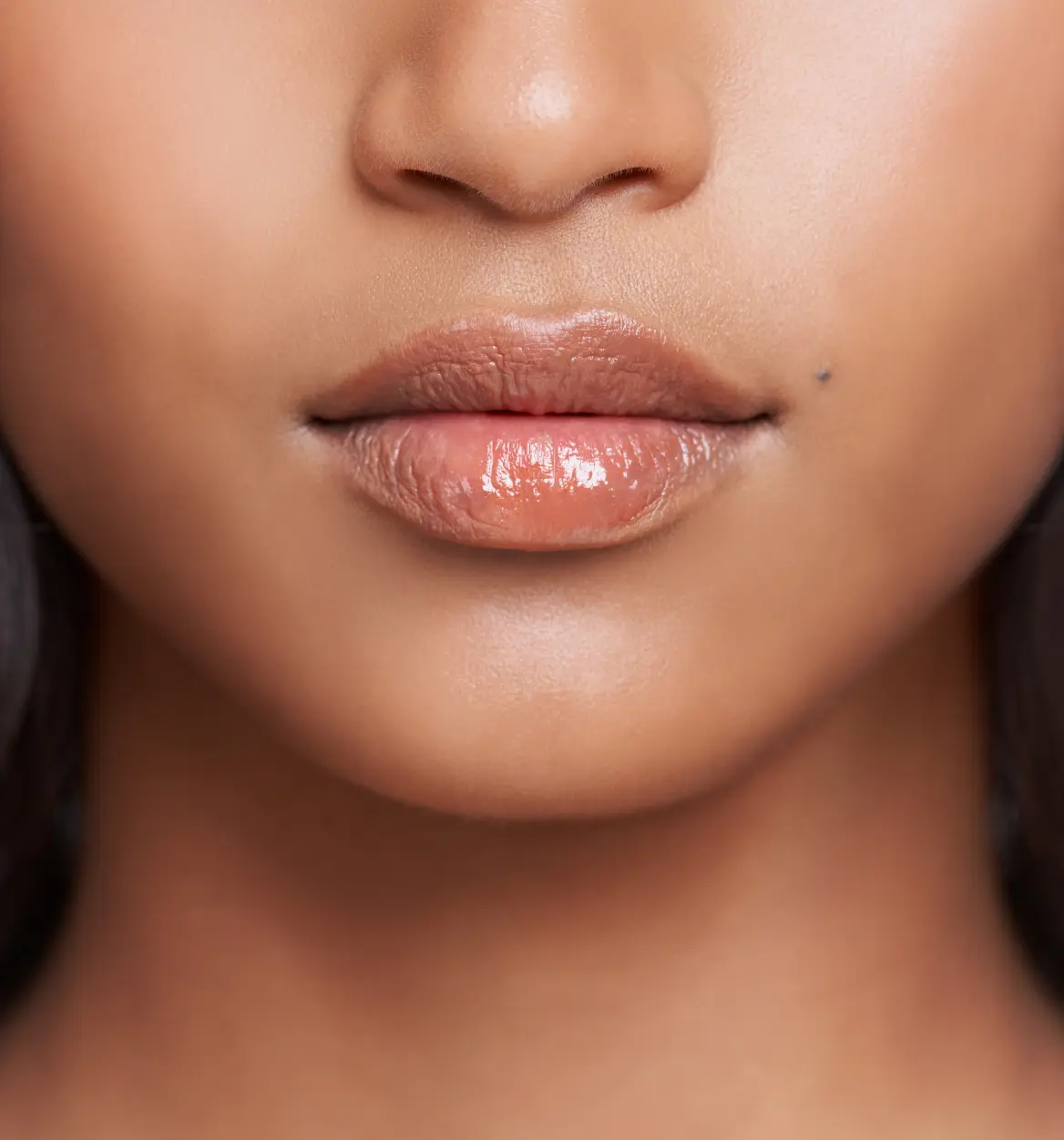 Lip Augmentation Procedure