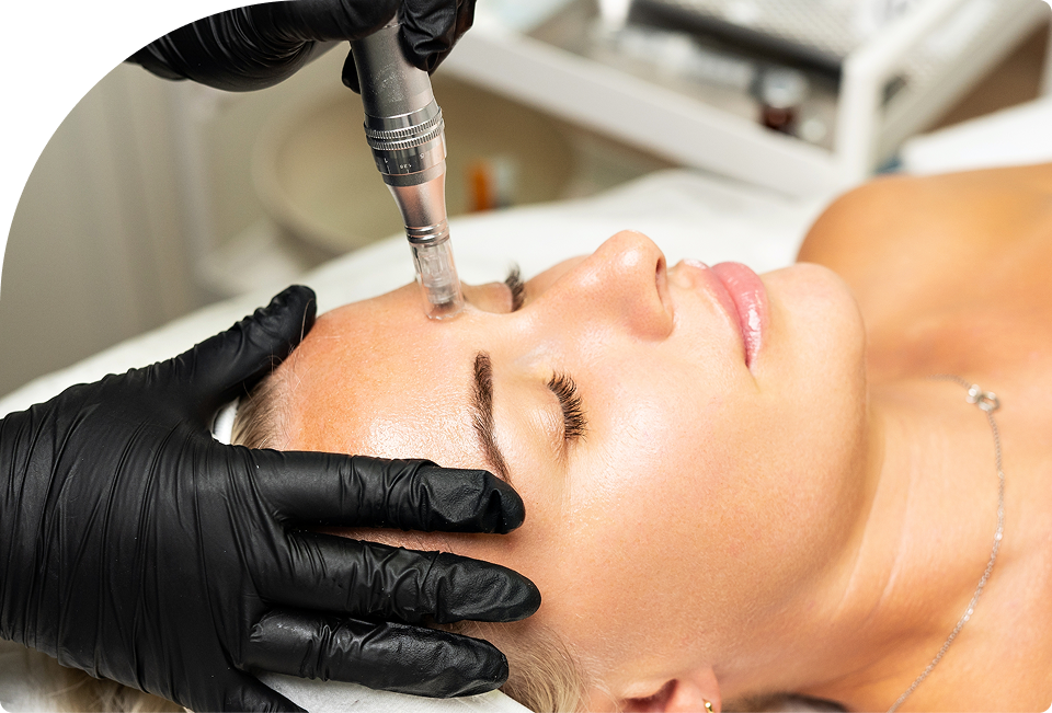 Microneedling NYC Banner