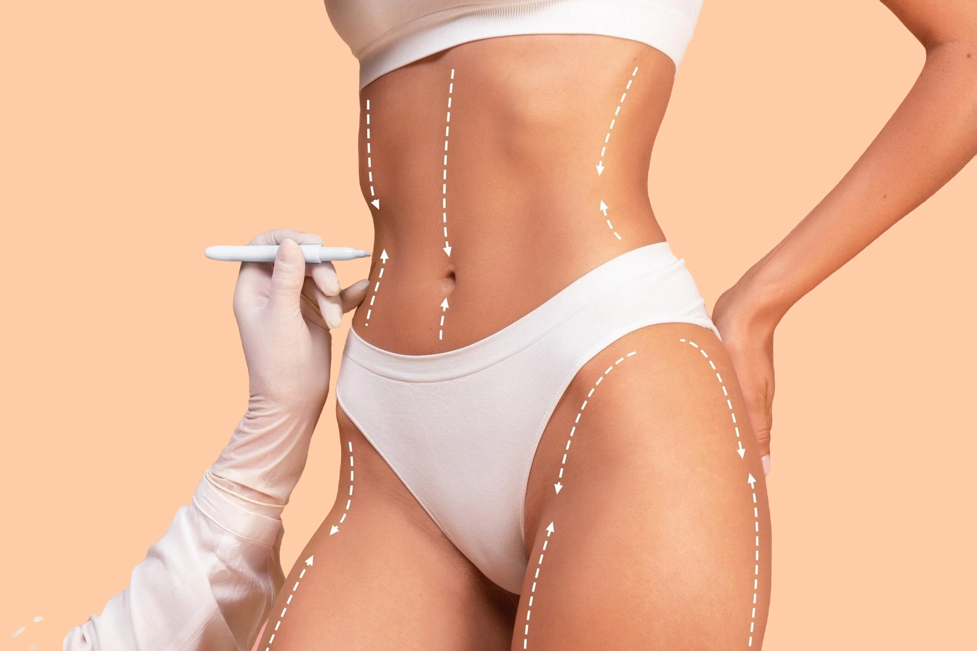 Is Liposuction Safe? Banner