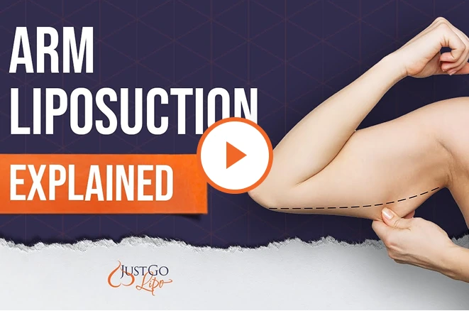 What Is Arm Liposuction Surgery? Banner