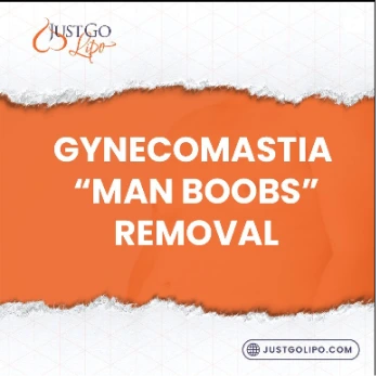 gynecomastia