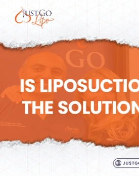 is liposuction the solution
