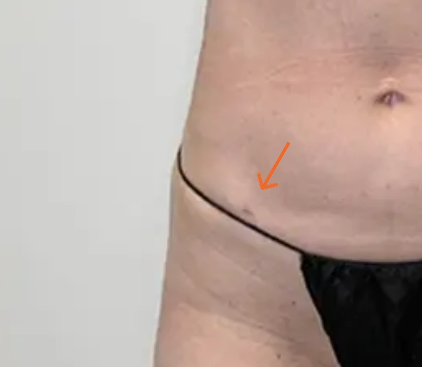 What Do Scars Look Like? Banner