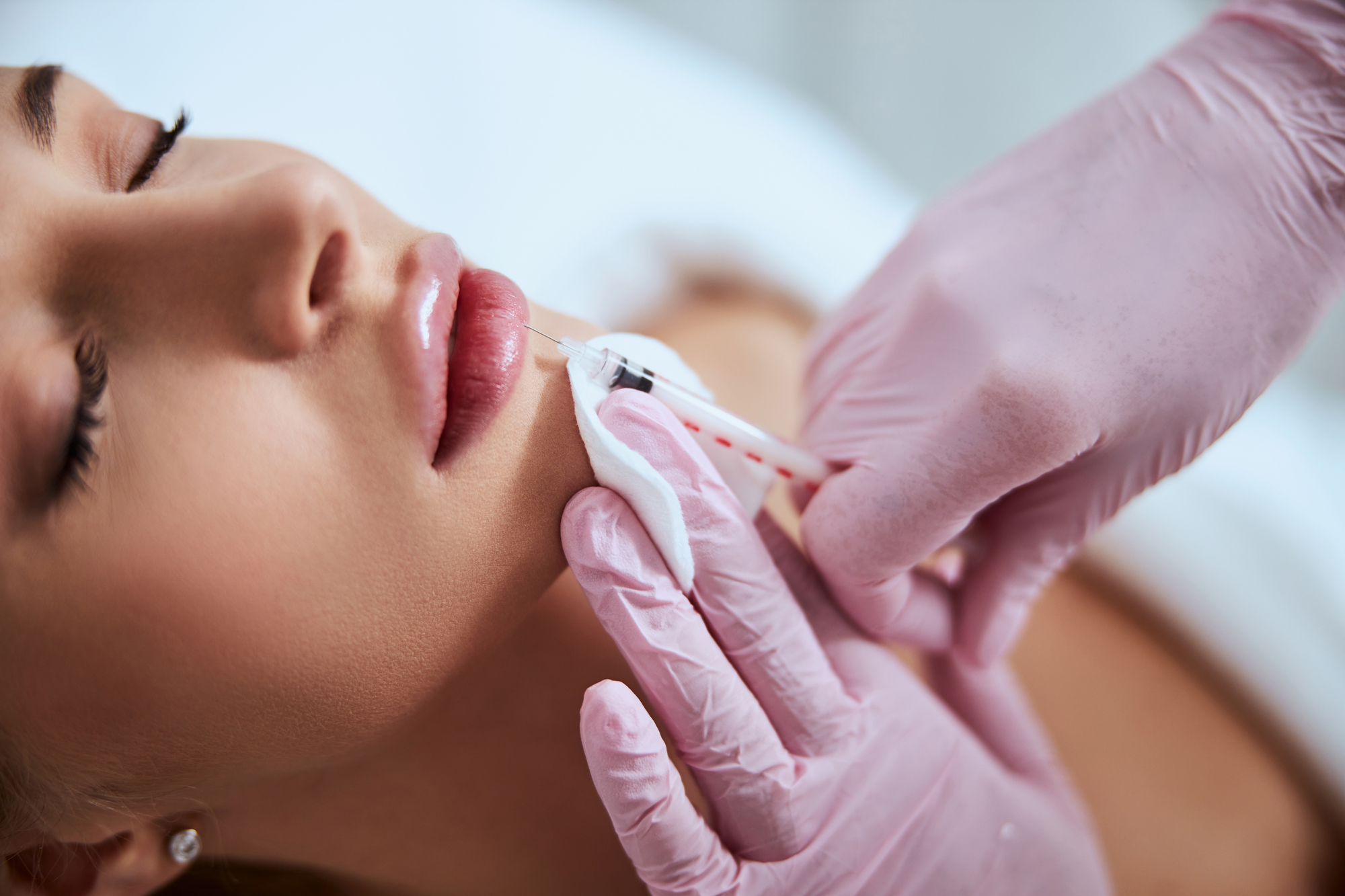 How Much Do Lip Fillers Cost? Banner