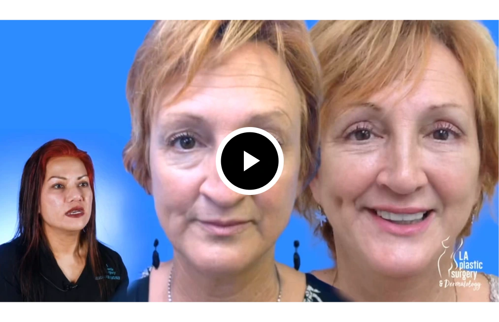 Initial Consultation & Preparation Video Thumbnail