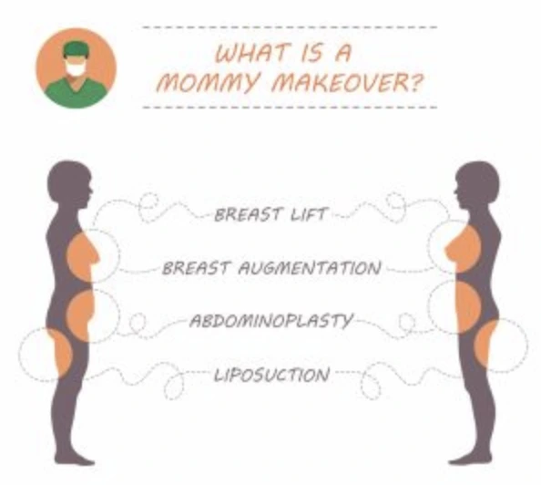 Mommy Makeover in Bradenton, FL Banner