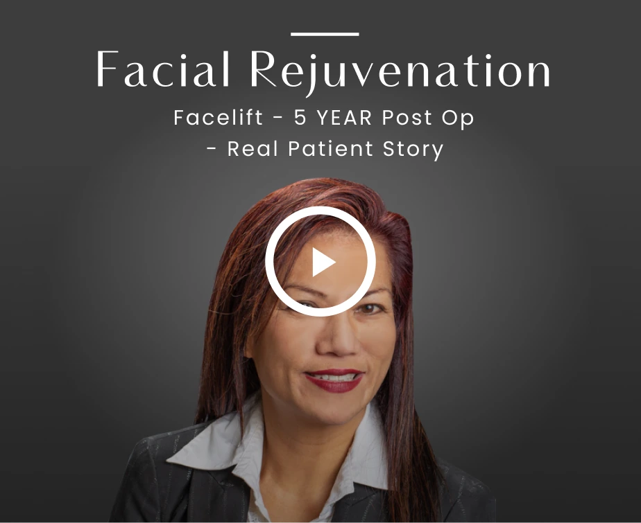 PLASMA LYFT Procedure Video 2 Thumbnail