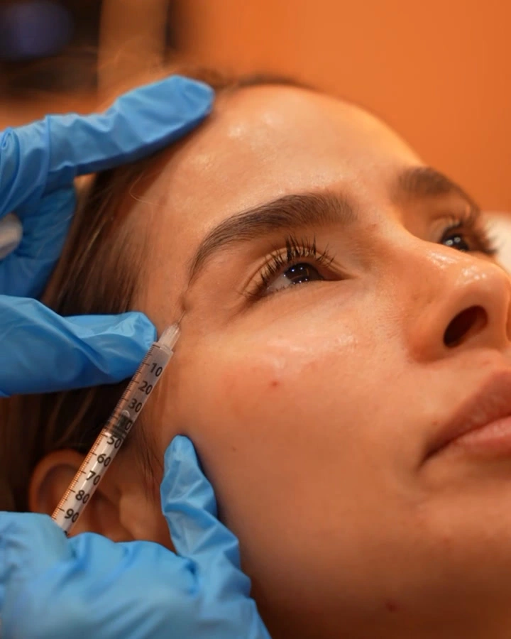 Neurotoxin injection to the forehead at La Réserve