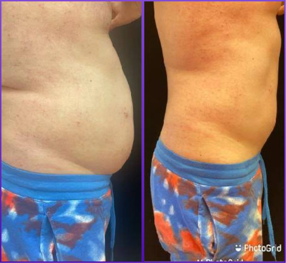 Before and After Gallery: Weight Loss Banner