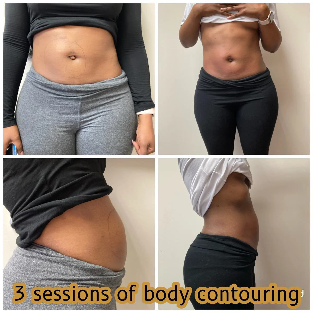 bodycontouring-new-03