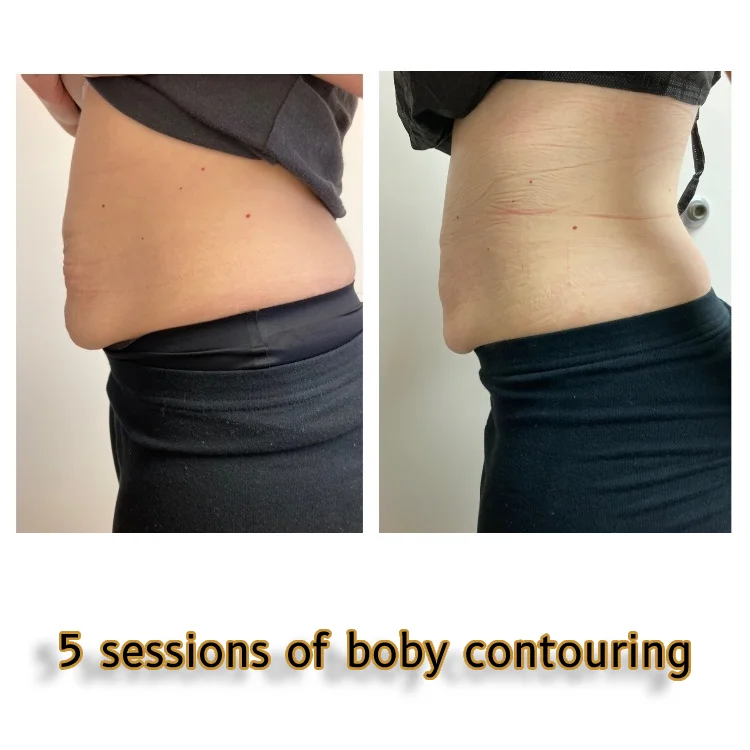 bodycontouring-new-05