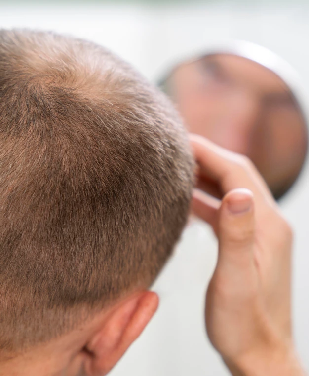 Causes of hair loss treatment las vegas banner