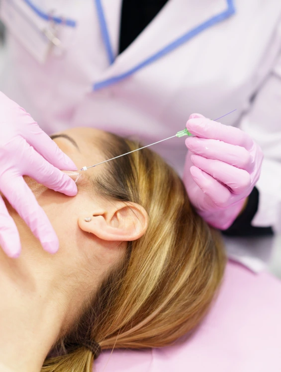 PDO Thread Lift Procedure Banner