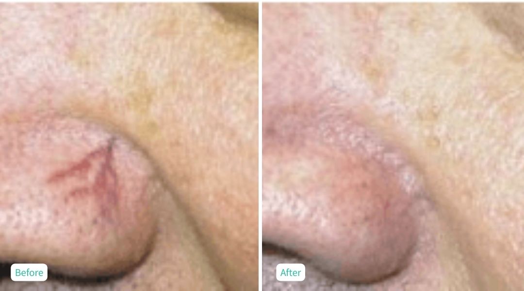 Skin Issues - Case 2