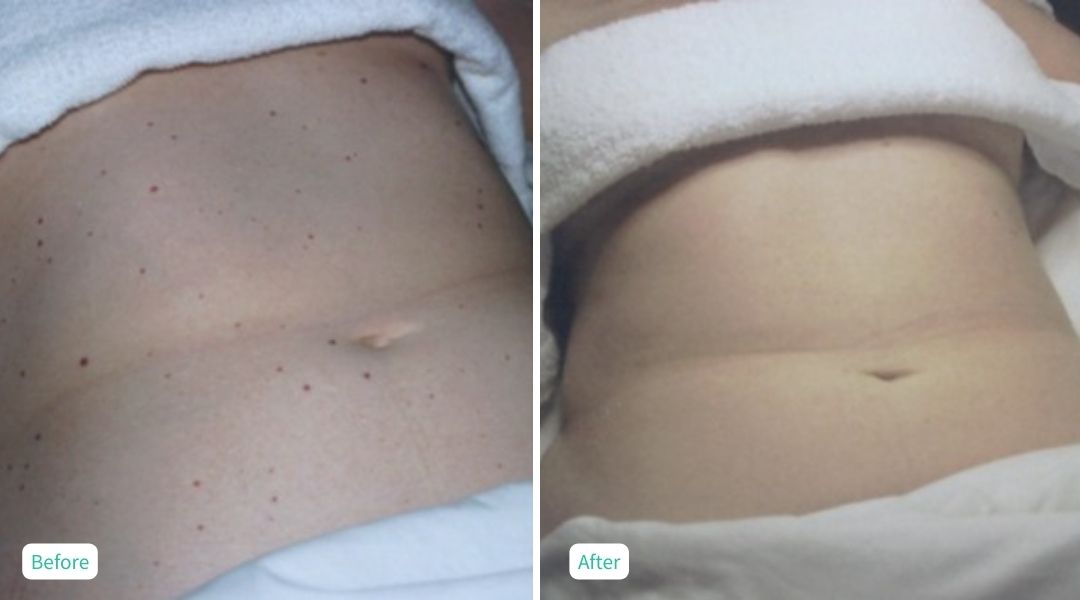 Skin Issues - Case 4