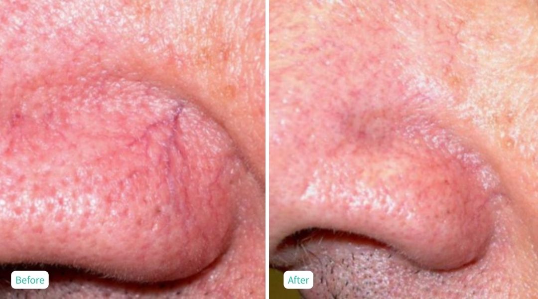 Skin Issues - Case 5