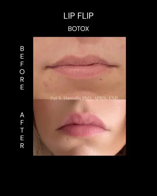 Lip Flip 2