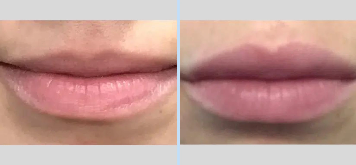 TemplateBefore After (53)