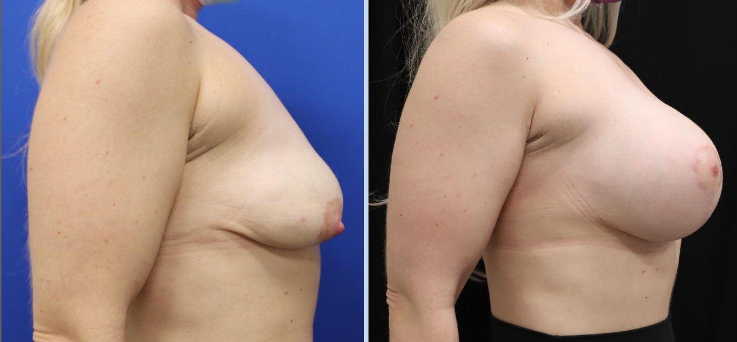 Untitled design (22)