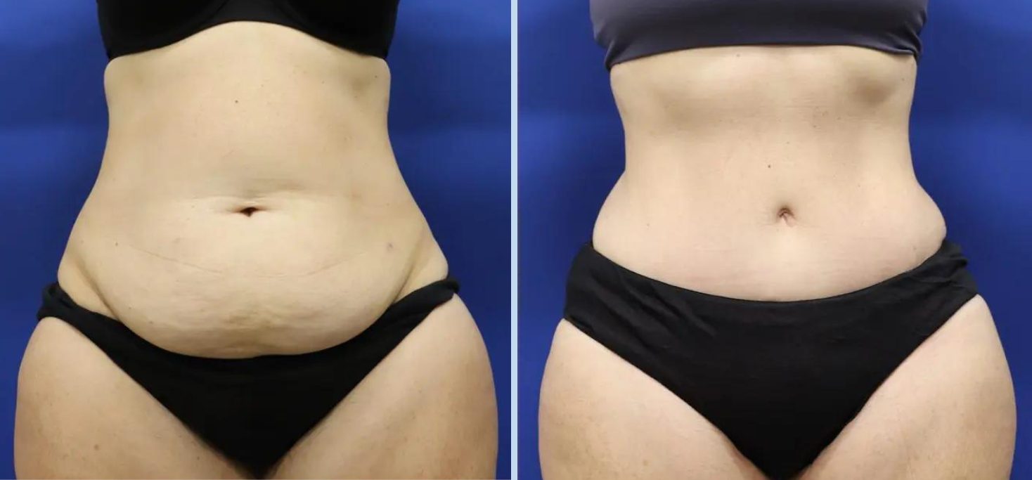 Untitled design (47)