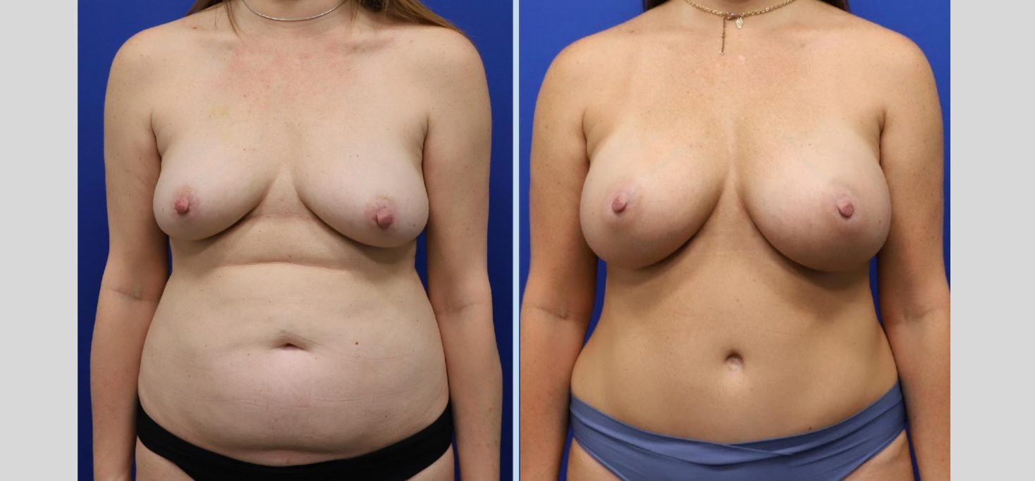 Untitled design (52)