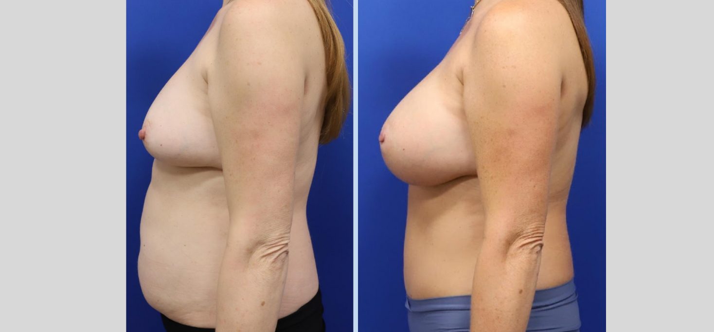 Untitled design (53)