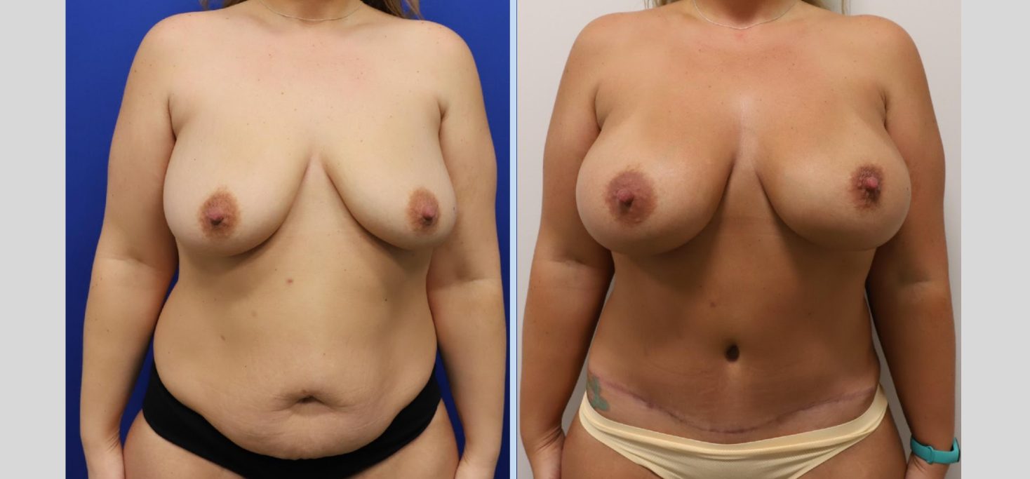 Untitled design (57)