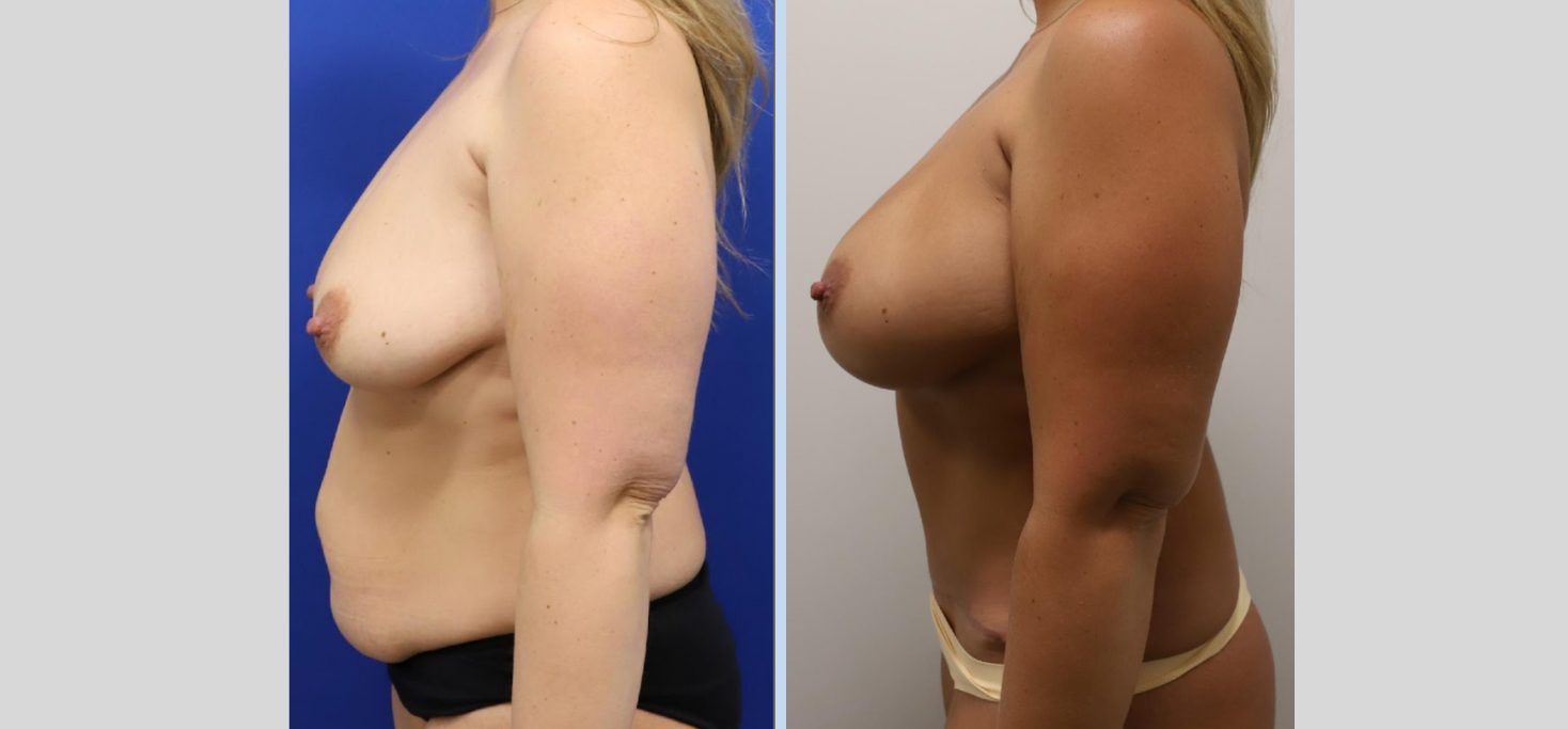 Untitled design (58)