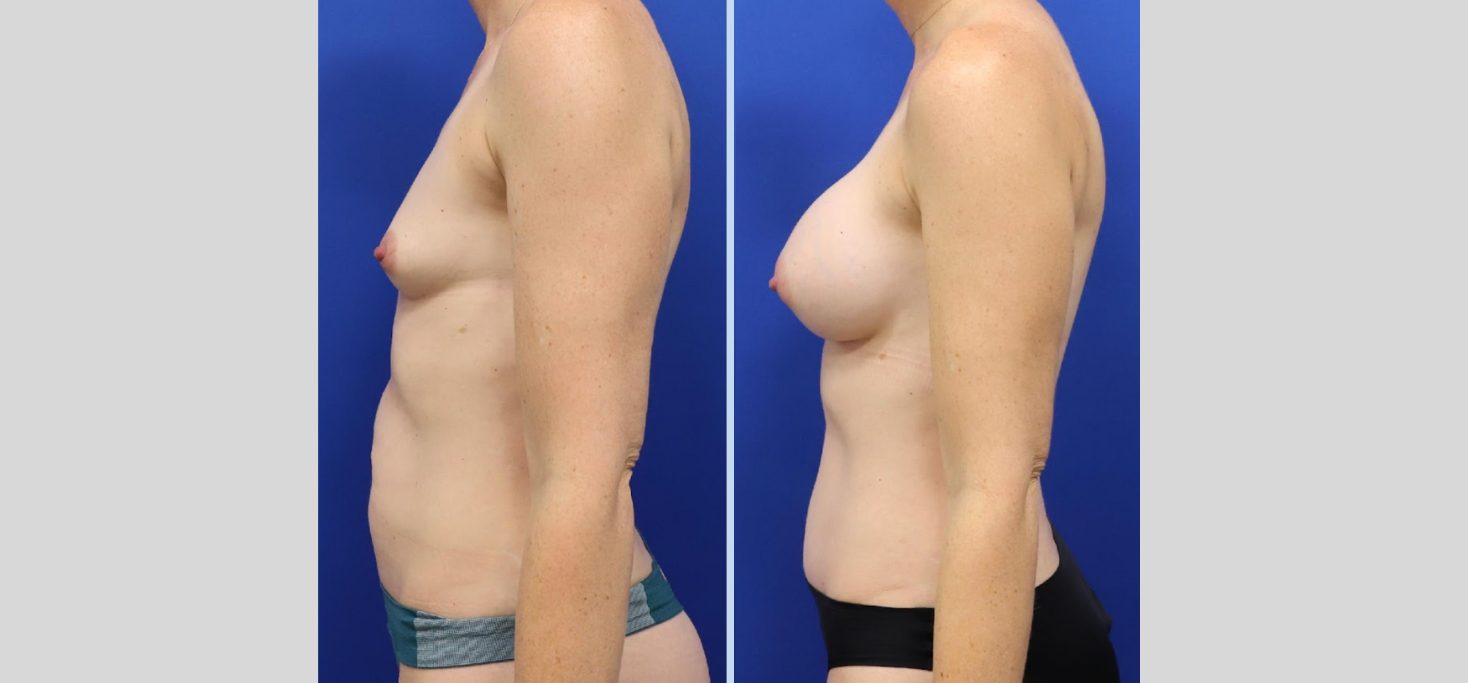 Untitled design (63)