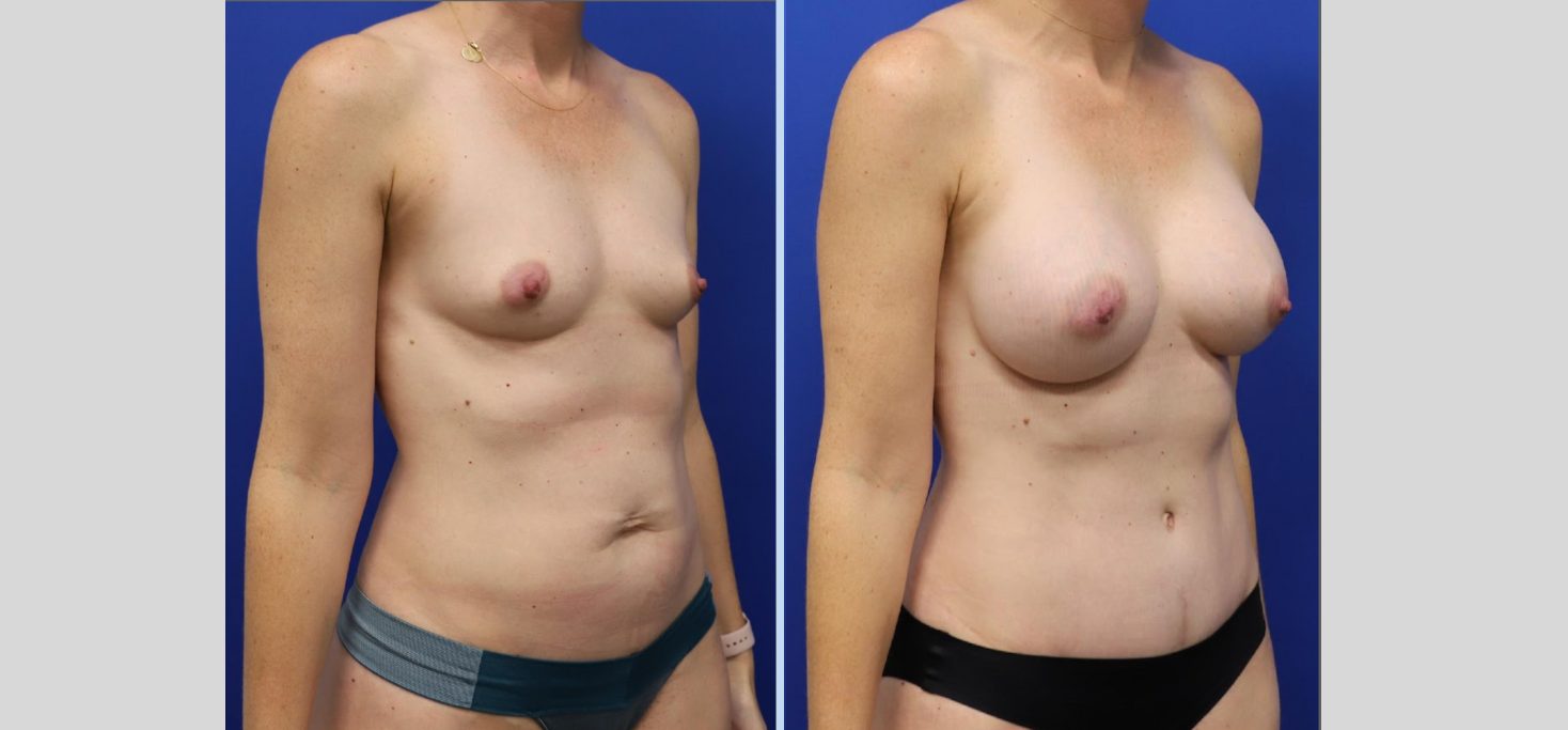 Untitled design (64)