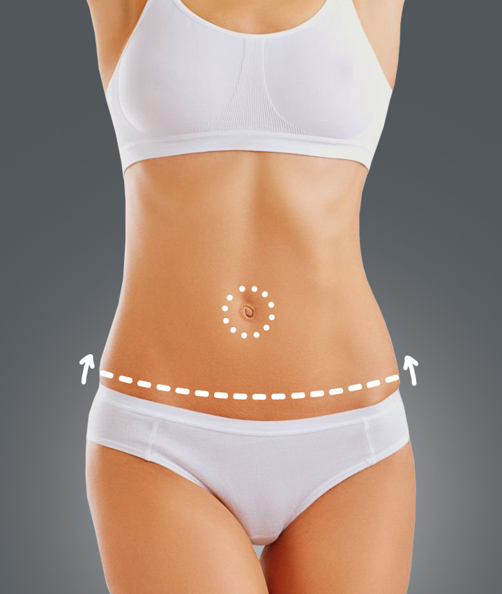Types of Tummy Tuck: Extended Tummy Tuck Banner
