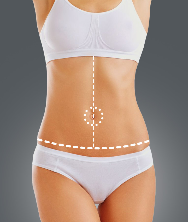 Types of Tummy Tuck: Fleur Tummy Tuck Banner