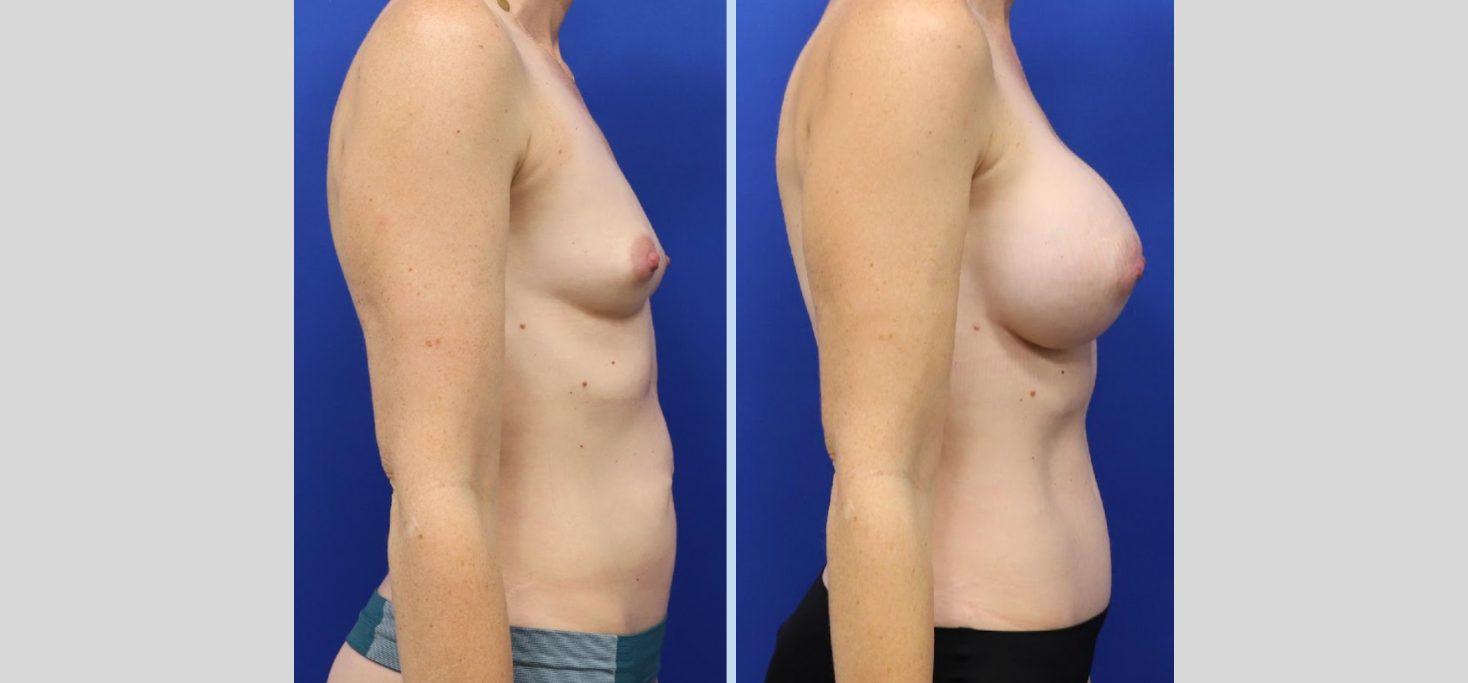 Untitled design - 2024-07-01T112103.354