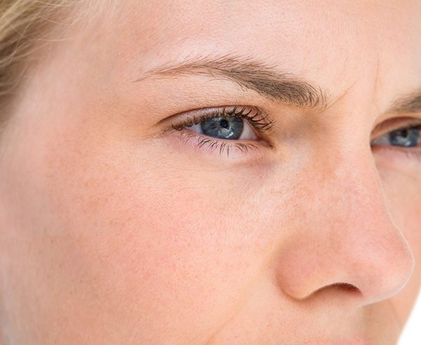 What Is Eyelid Surgery Banner