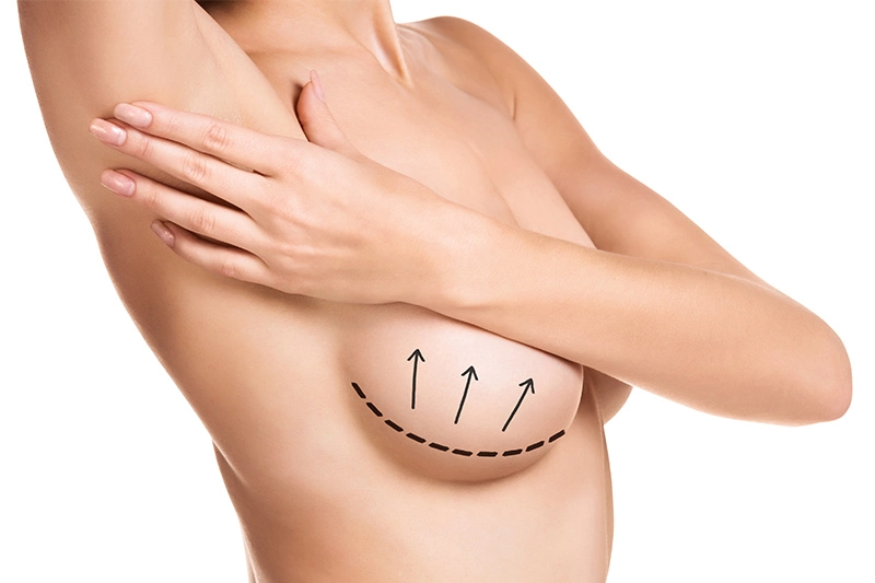 Breast Reconstruction in Miami, FL Banner