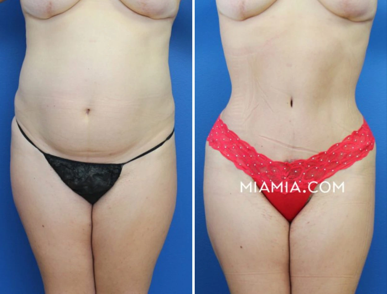 Untitled design (23)