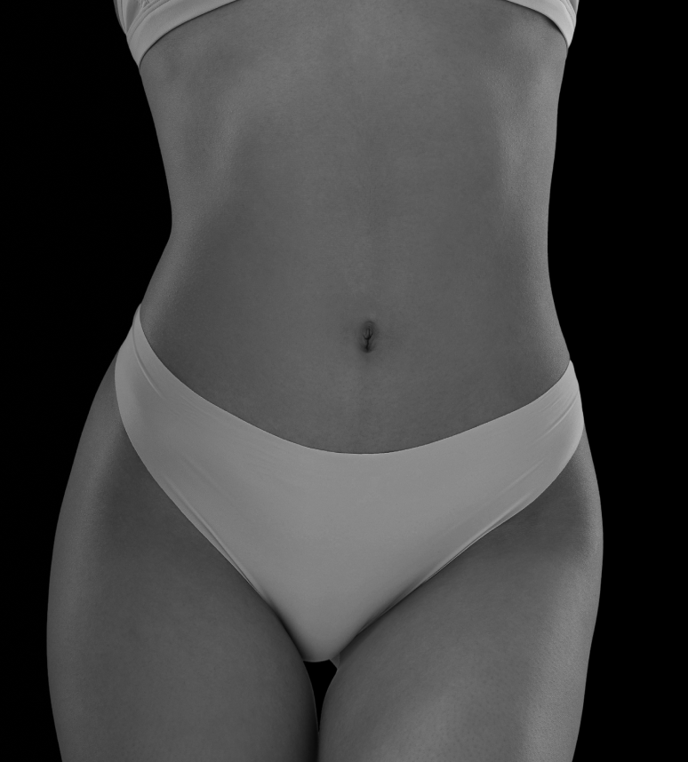 Woman's torso showing smooth, contoured abdomen and waistline after extended tummy tuck