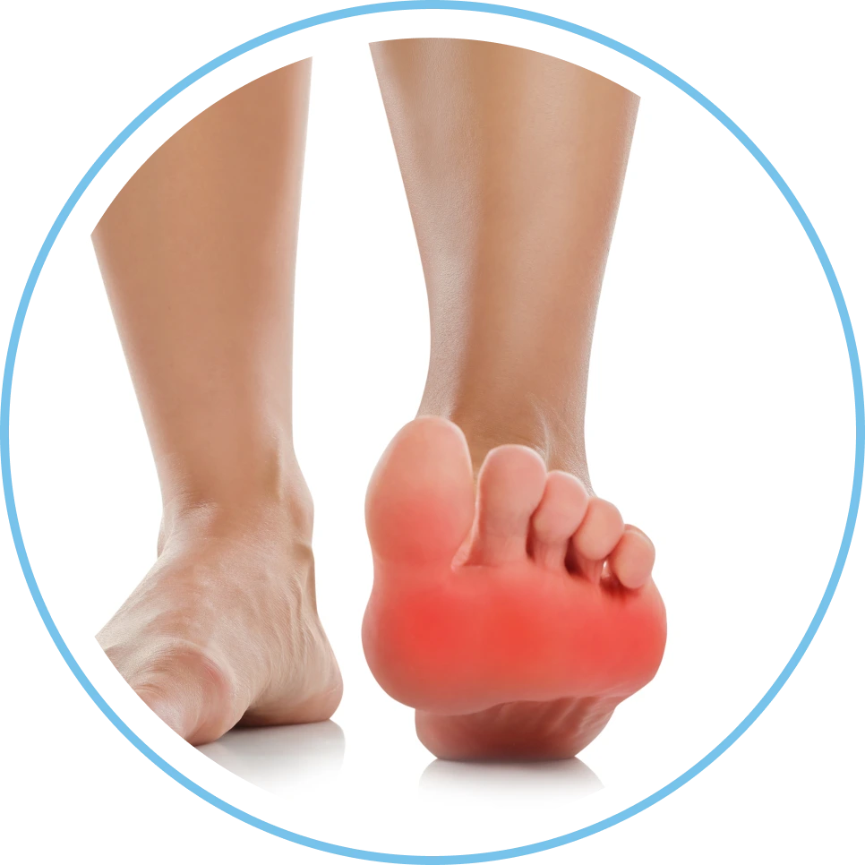 What Is Metatarsalgia? Banner