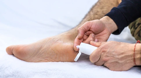 Topical Antifungal image