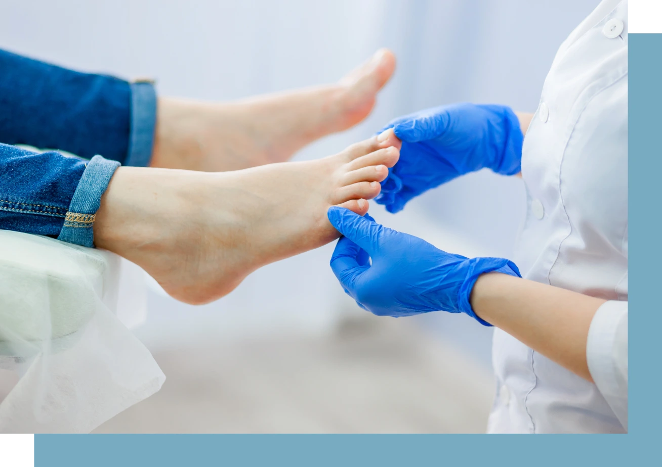 Fungal Toenail Condition
