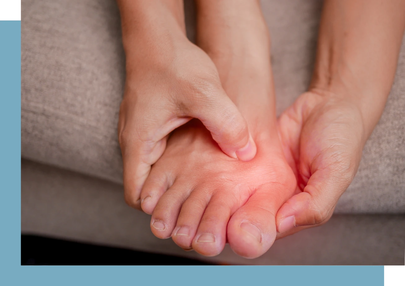 Hallux Limitus Condition