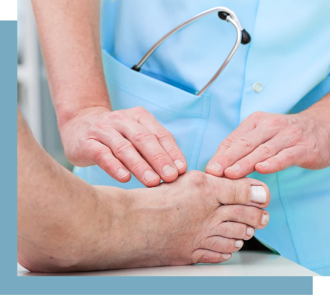 Bunion Removal Surgery: A Step-by-Step Guide Banner