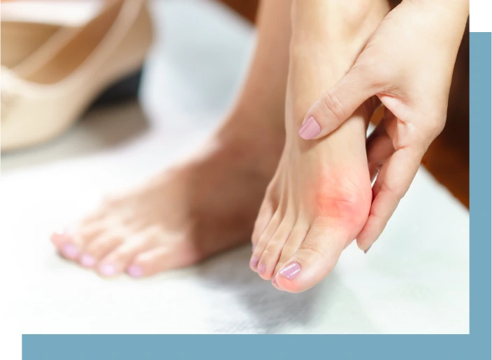 How Do I Know If I Have Bunion Deformity? Banner
