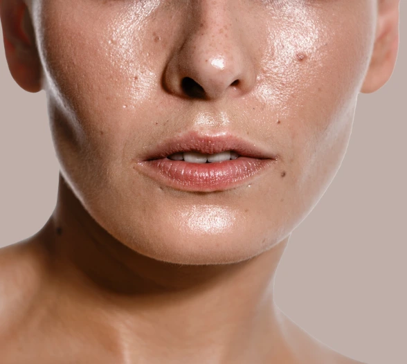 About hyperhidrosis Banner