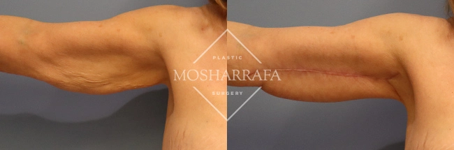 case 285 (1)