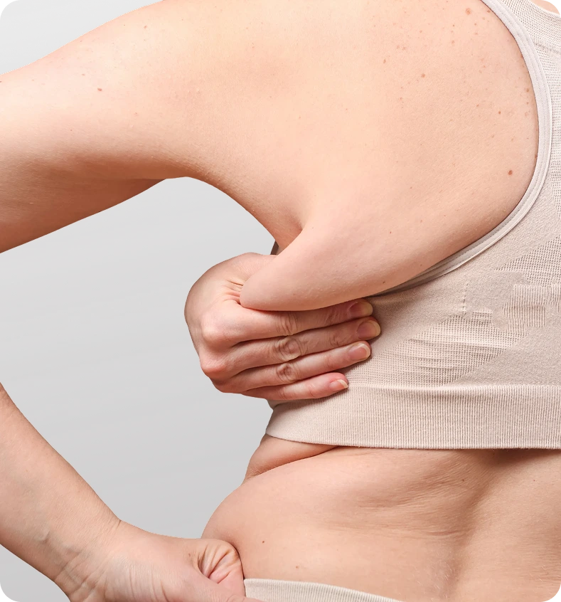 Person pinching abdominal skin to demonstrate body composition assessment