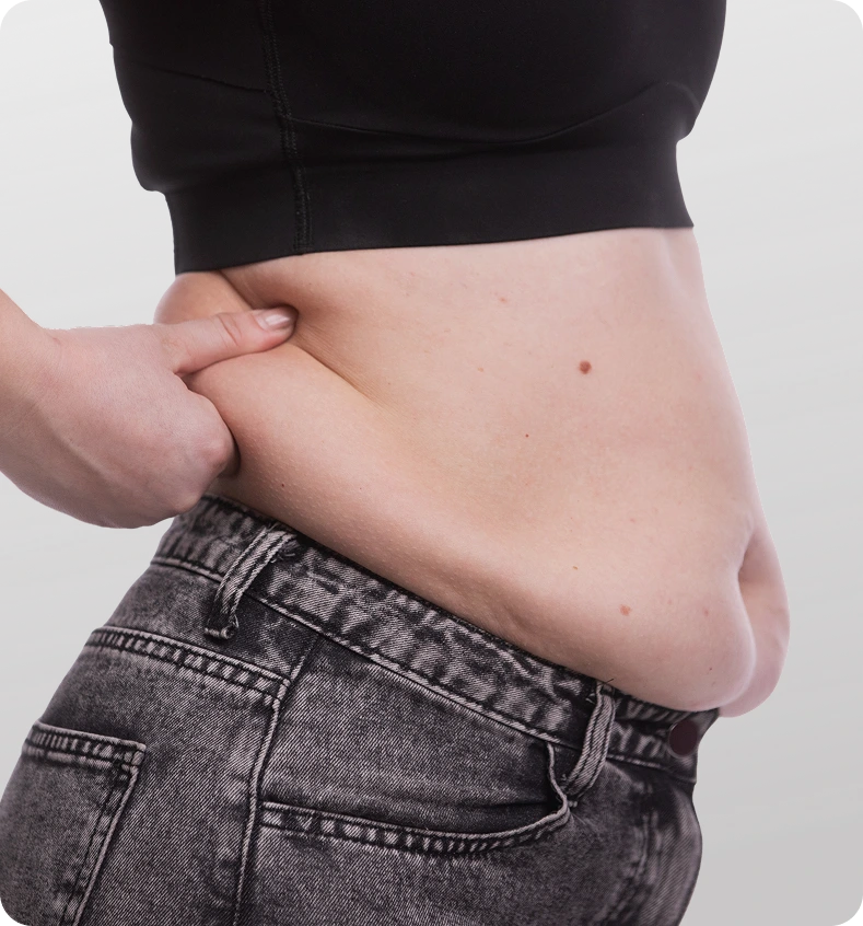 Person pinching abdominal skin to demonstrate body composition or candidacy assessment