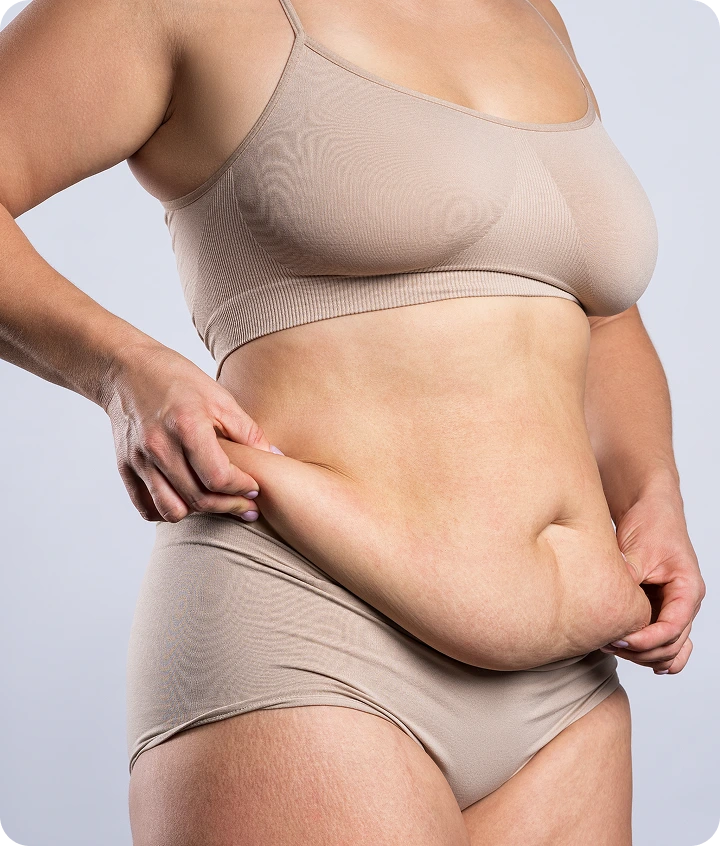 Person with toned abdominal contours and improved skin firmness after body contouring procedure