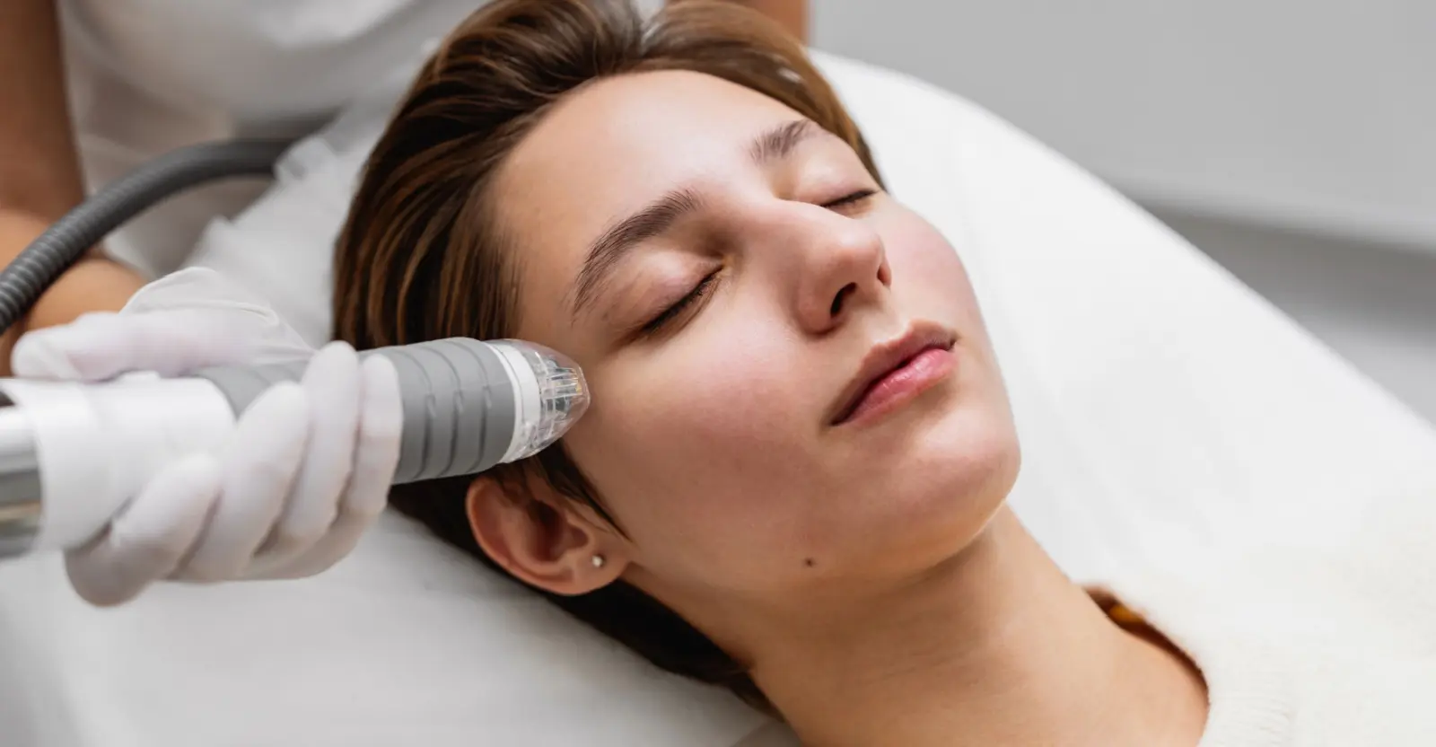 Patient receiving Secret RF microneedling treatment on her face at Natural Beauty Fifth Avenue